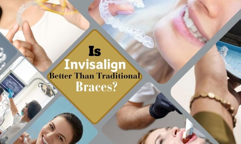 Traditional Braces